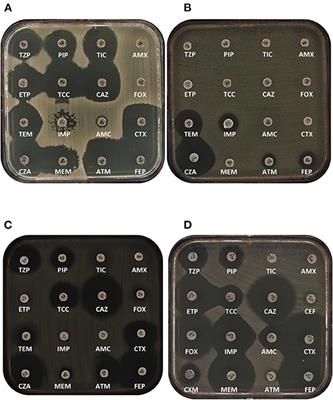 Genetic Diversity, Biochemical Properties, and Detection Methods of Minor Carbapenemases in Enterobacterales